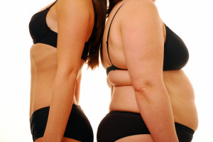 ожирение до и после