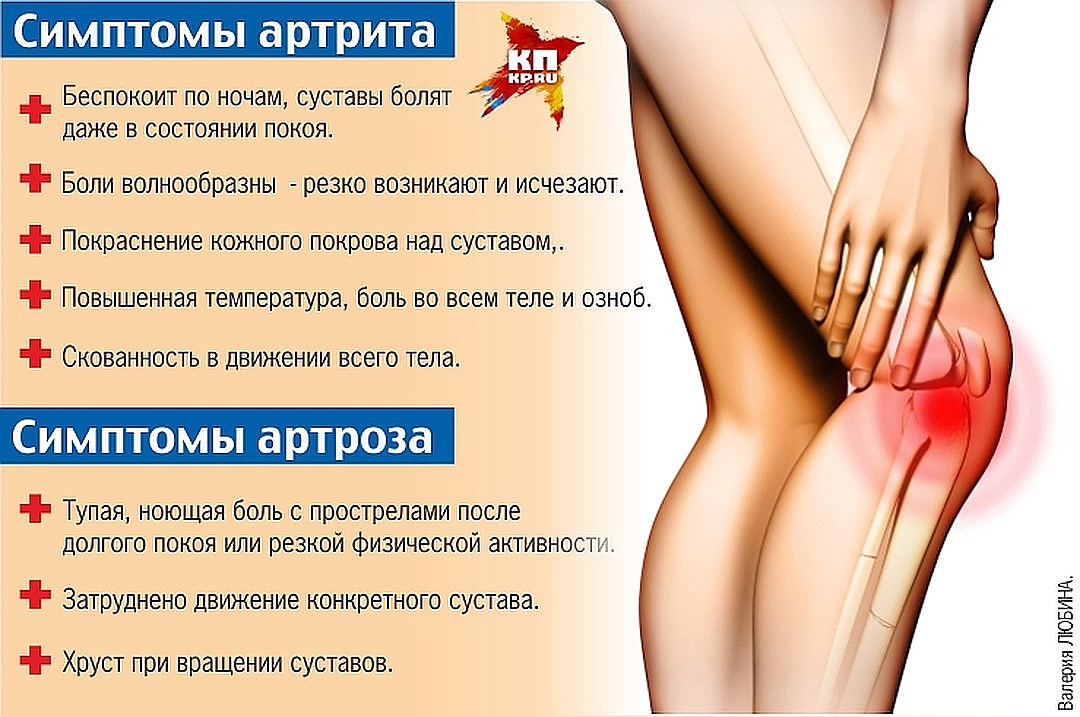 koleno-artrit-artroz